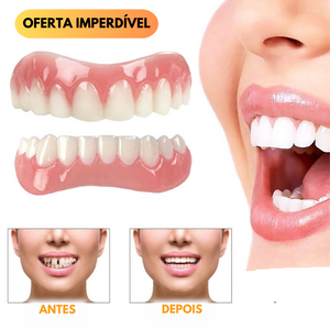 Dentadura Universal NewSmile - FRETE GRÁTIS